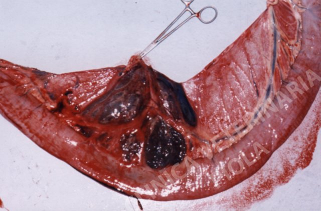 Pseudo diverticolo